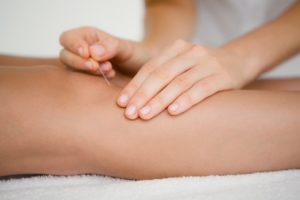 How Does Acupuncture Work